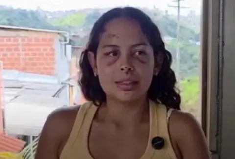 La voz de una bombera, la respiración que dio aliento a Ana, una nadadora rescatada de los escombros en Manizales